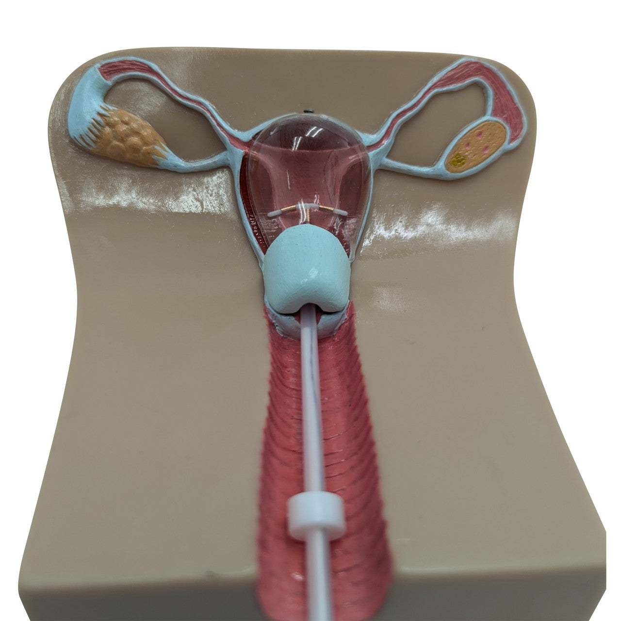 The Anatomy Lab-A-104452 IUD Insertion Model I, 1/ea