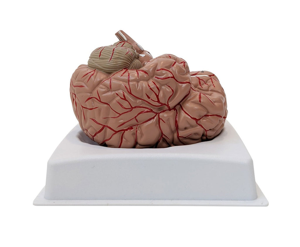 Lab Class Model Brain Anatomy Lab Basic 2-Part Brain Model – With or Without Arteries & Blood ...