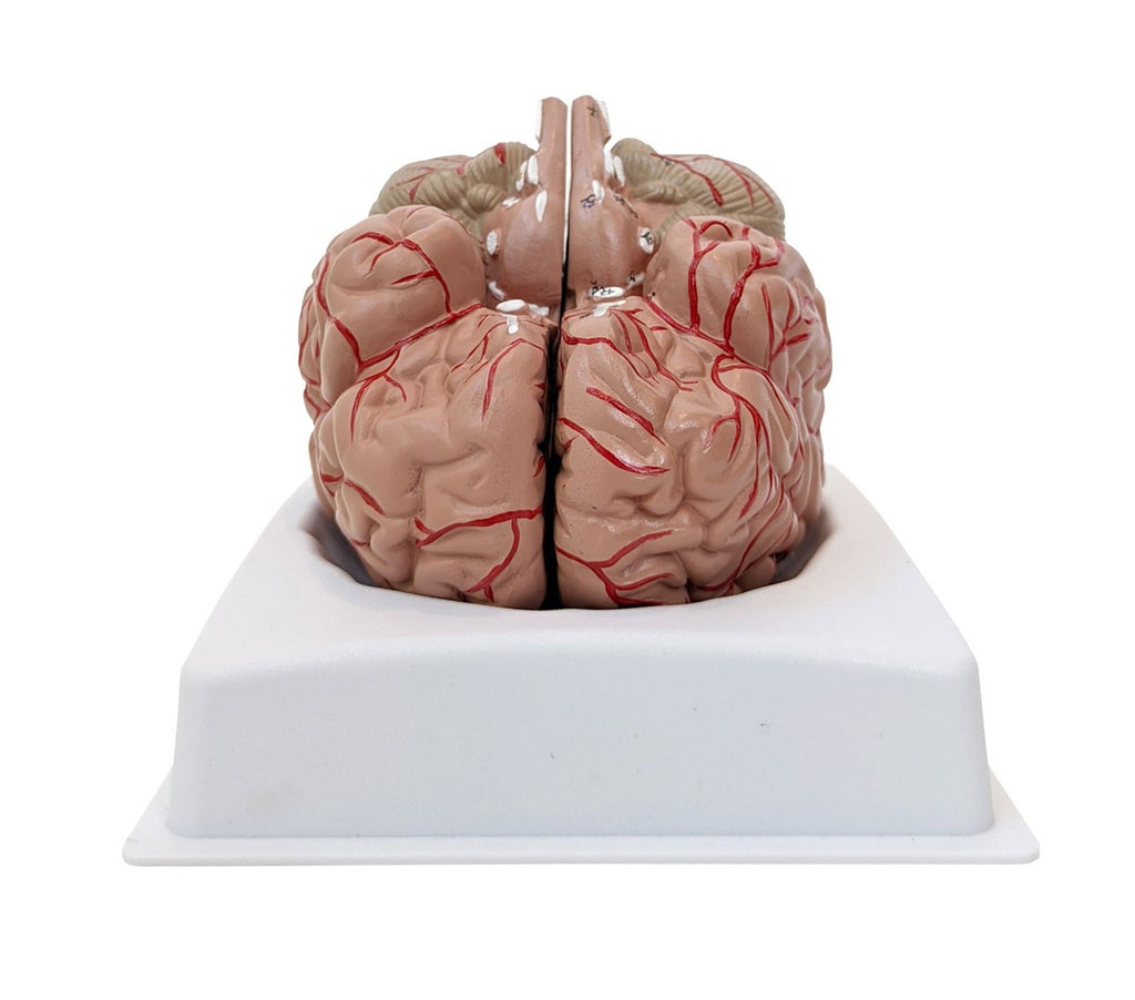 Lab Class Model Brain Anatomy Lab Basic 2-Part Brain Model – With or Without Arteries & Blood ...