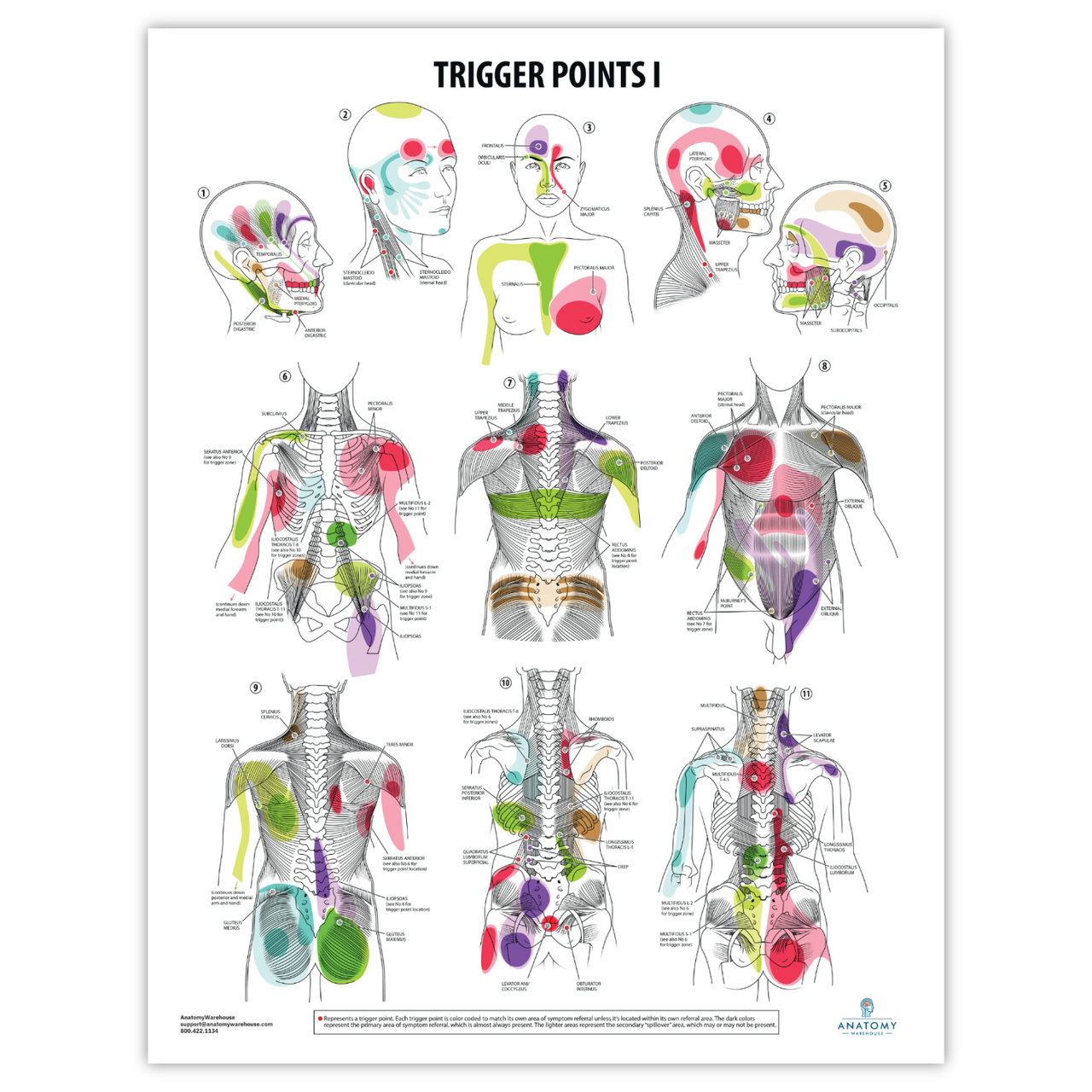 The Anatomy Lab-A-112554 Trigger Points I Laminated Poster, EACH
