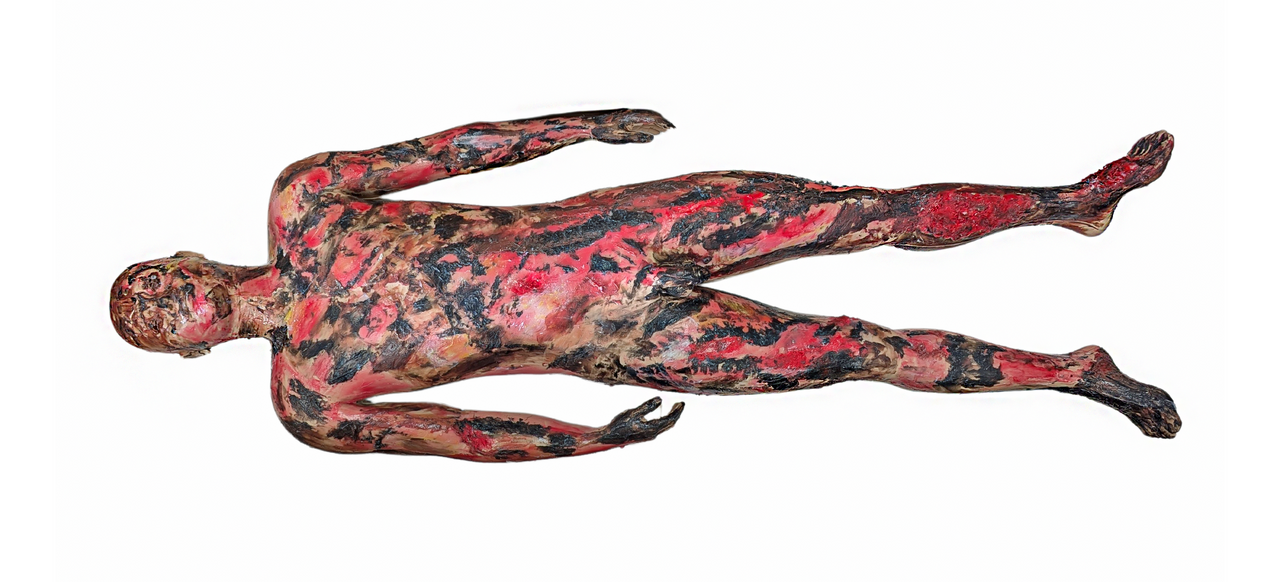 The Anatomy Lab-A-112555 Full-Body Burn Assessment Manikin, EACH
