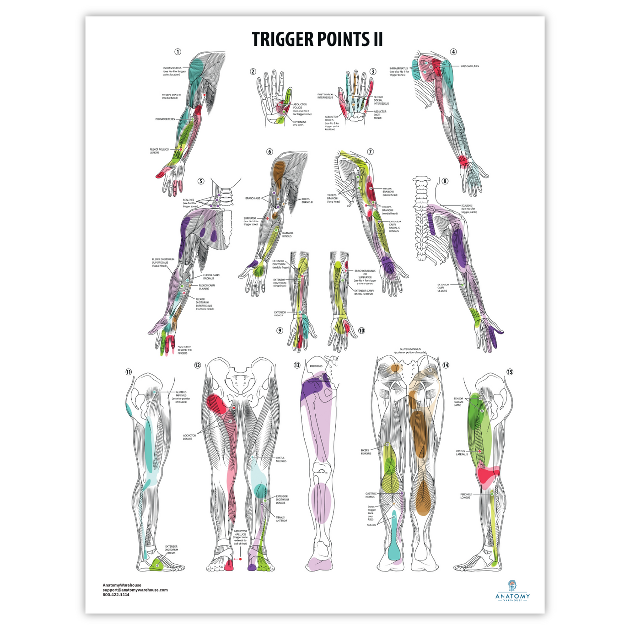 The Anatomy Lab-A-112849 Trigger Points I & II Laminated Poster Set, 1/set