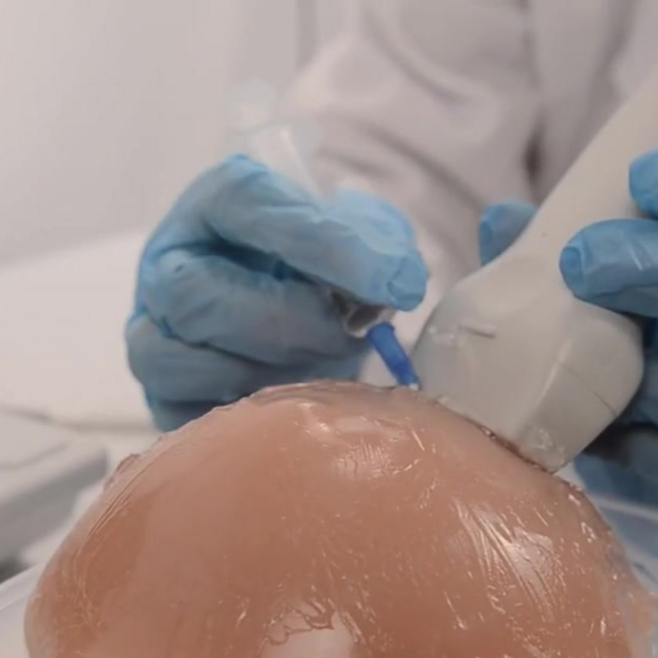 The Anatomy Lab-A-112906 Breast Biopsy Ultrasound Training Model, 1/EA