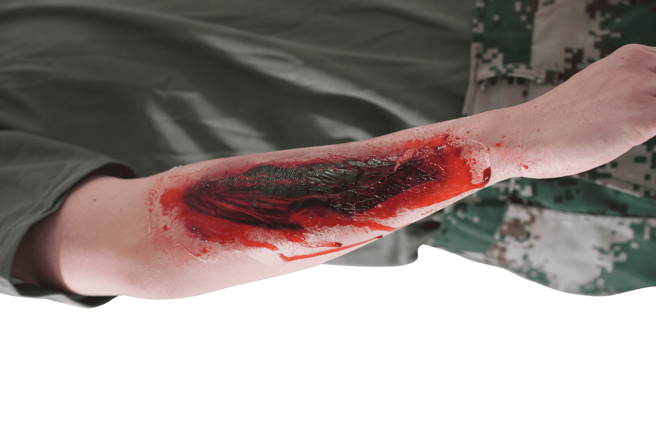 The Anatomy Lab-A-112991 Trauma Quick Kit, 1/set