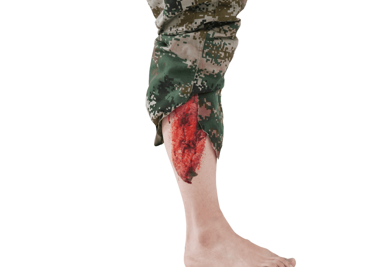 The Anatomy Lab-A-112991 Trauma Quick Kit, 1/set