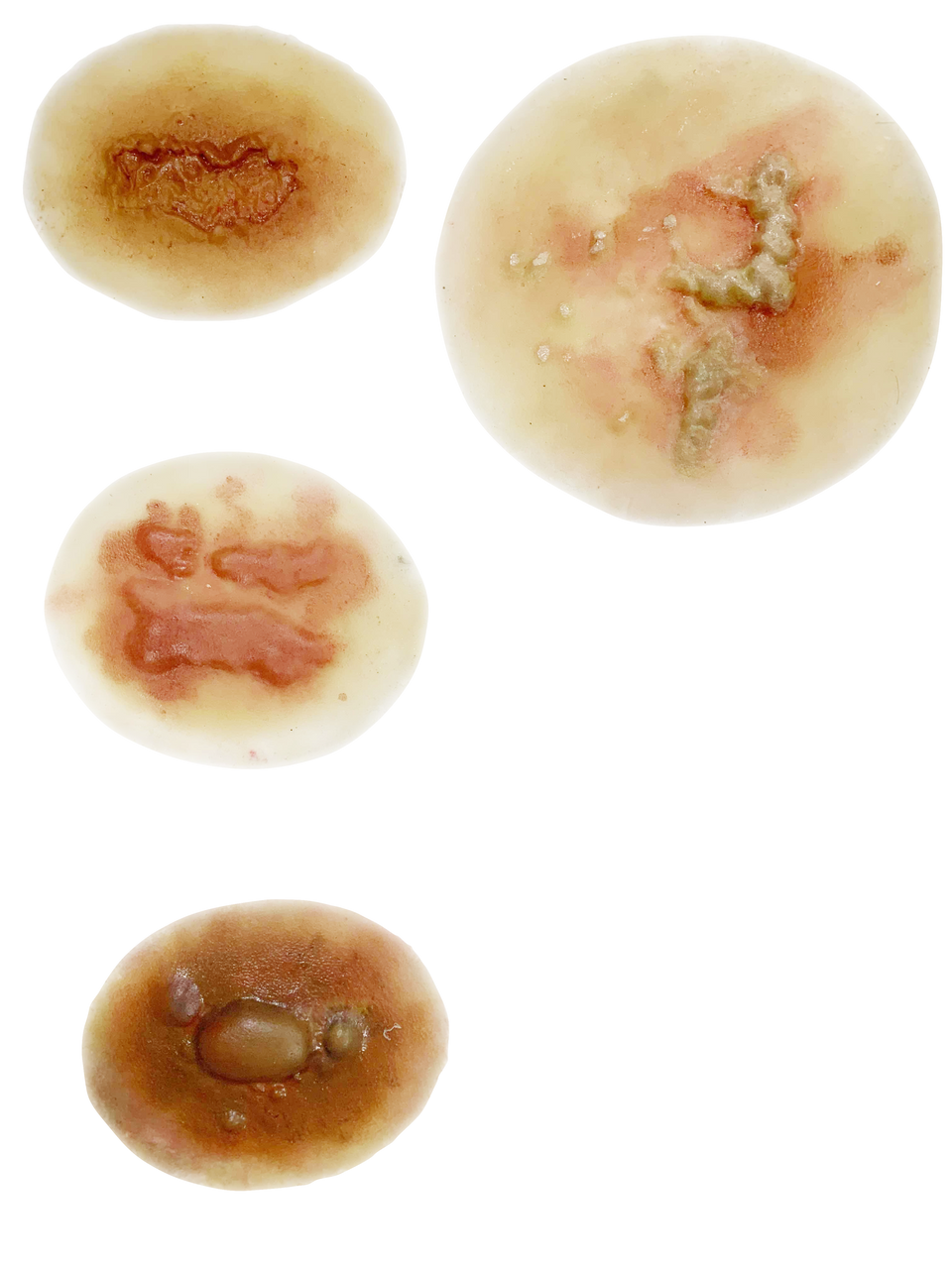 The Anatomy Lab-A-113003 Insect & Snake Bites Moulage Kit, 1/ea