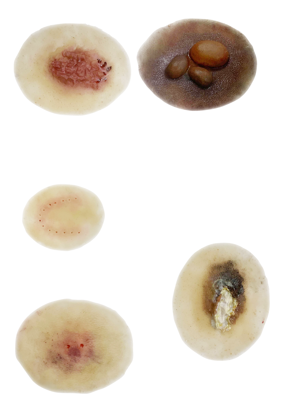 The Anatomy Lab-A-113003 Insect & Snake Bites Moulage Kit, 1/ea