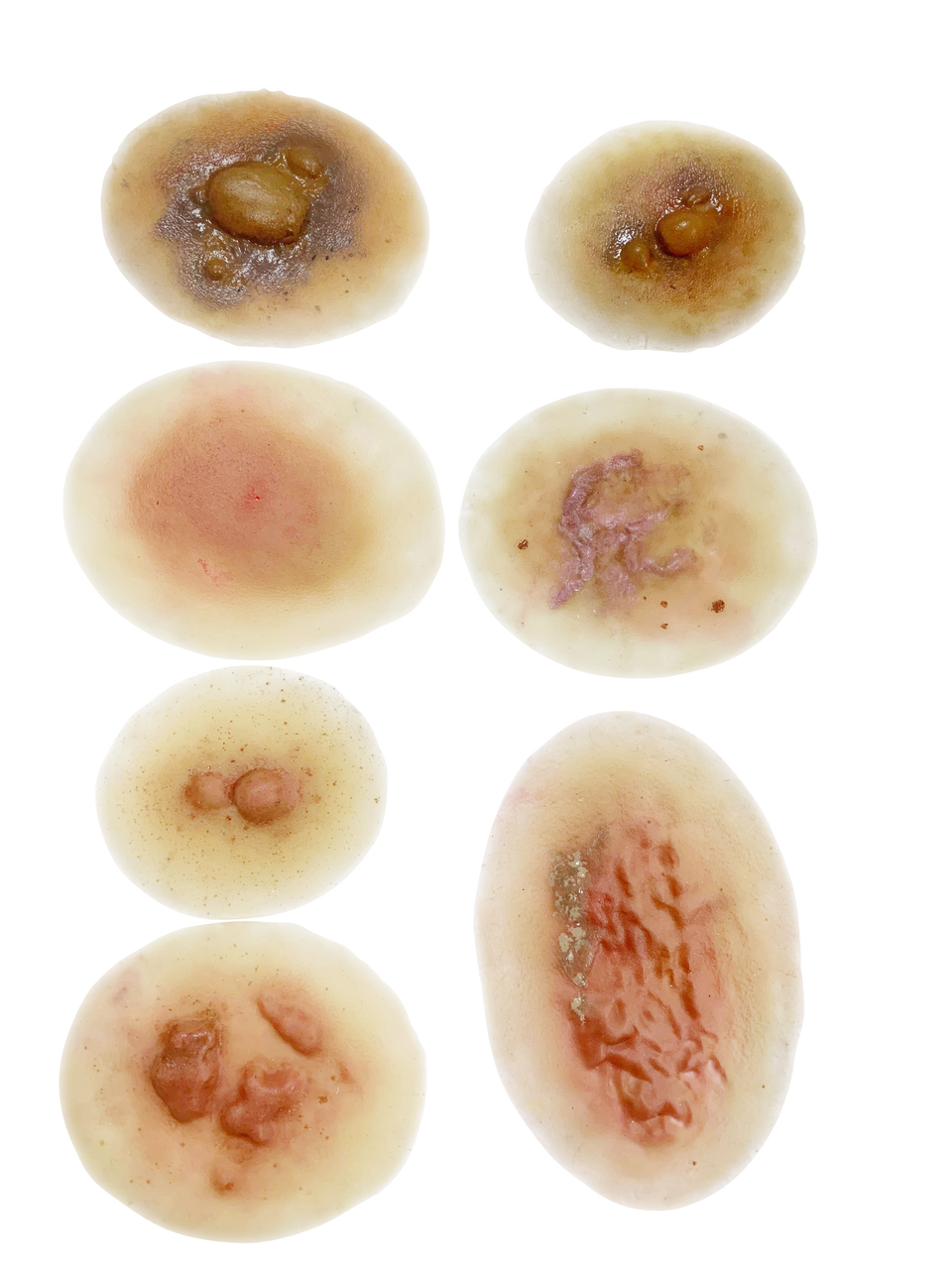 The Anatomy Lab-A-113003 Insect & Snake Bites Moulage Kit, 1/ea