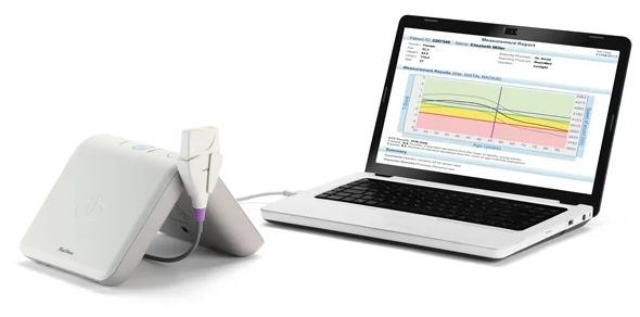 BeamMed Sunlight MiniOmni Ultrasound Bone Sonometer