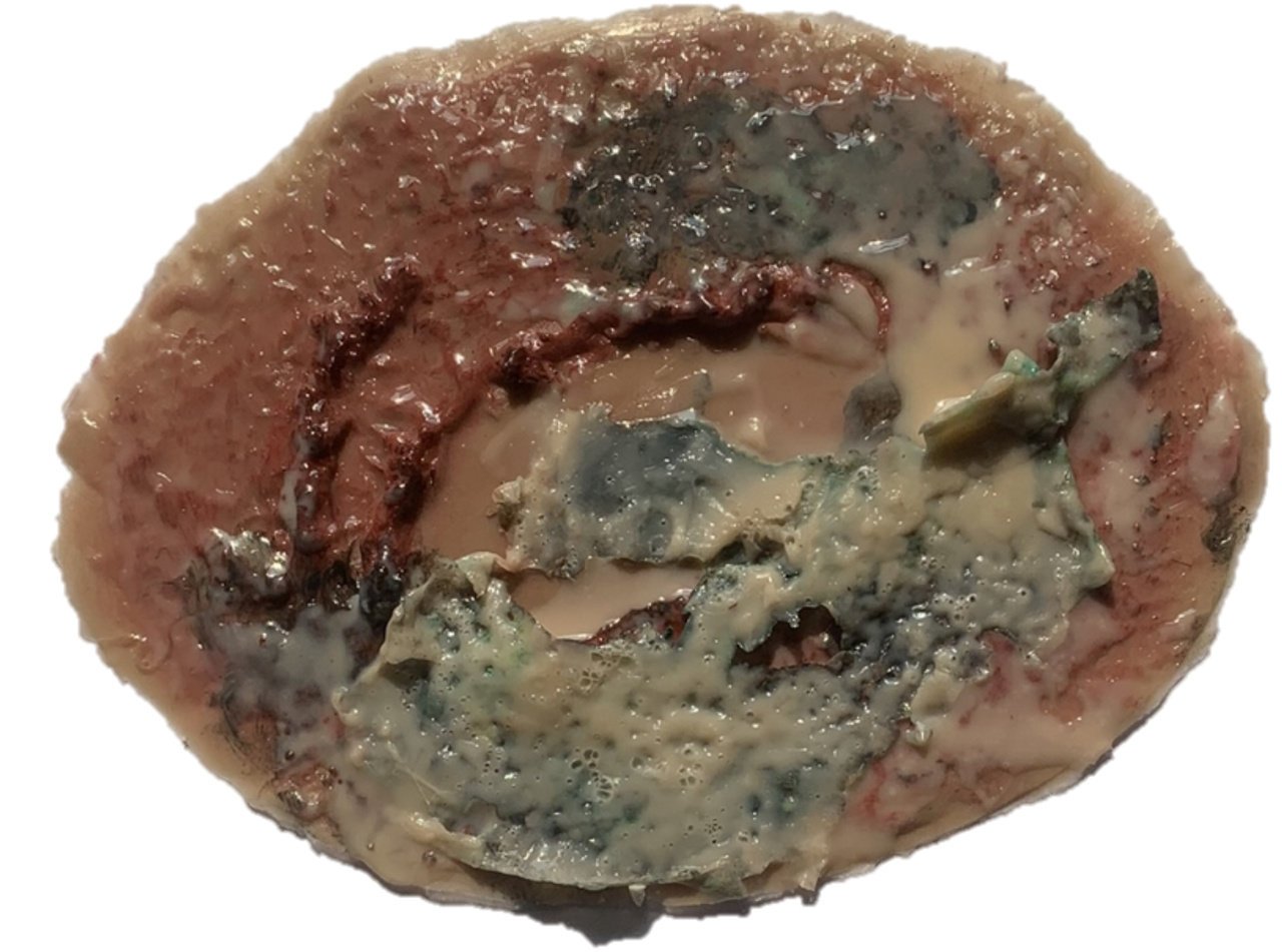 The Anatomy Lab-A-112998 CBRN Injury Moulage Kit, 1/set