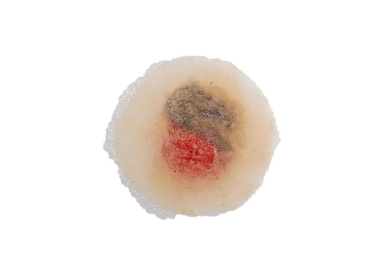 The Anatomy Lab-A-112998 CBRN Injury Moulage Kit, 1/set