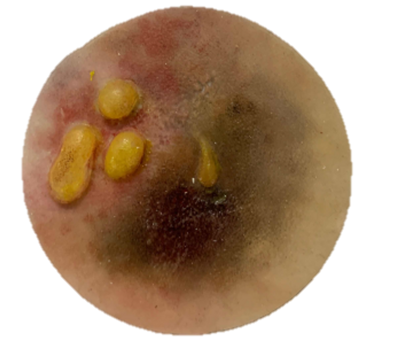 The Anatomy Lab-A-112998 CBRN Injury Moulage Kit, 1/set