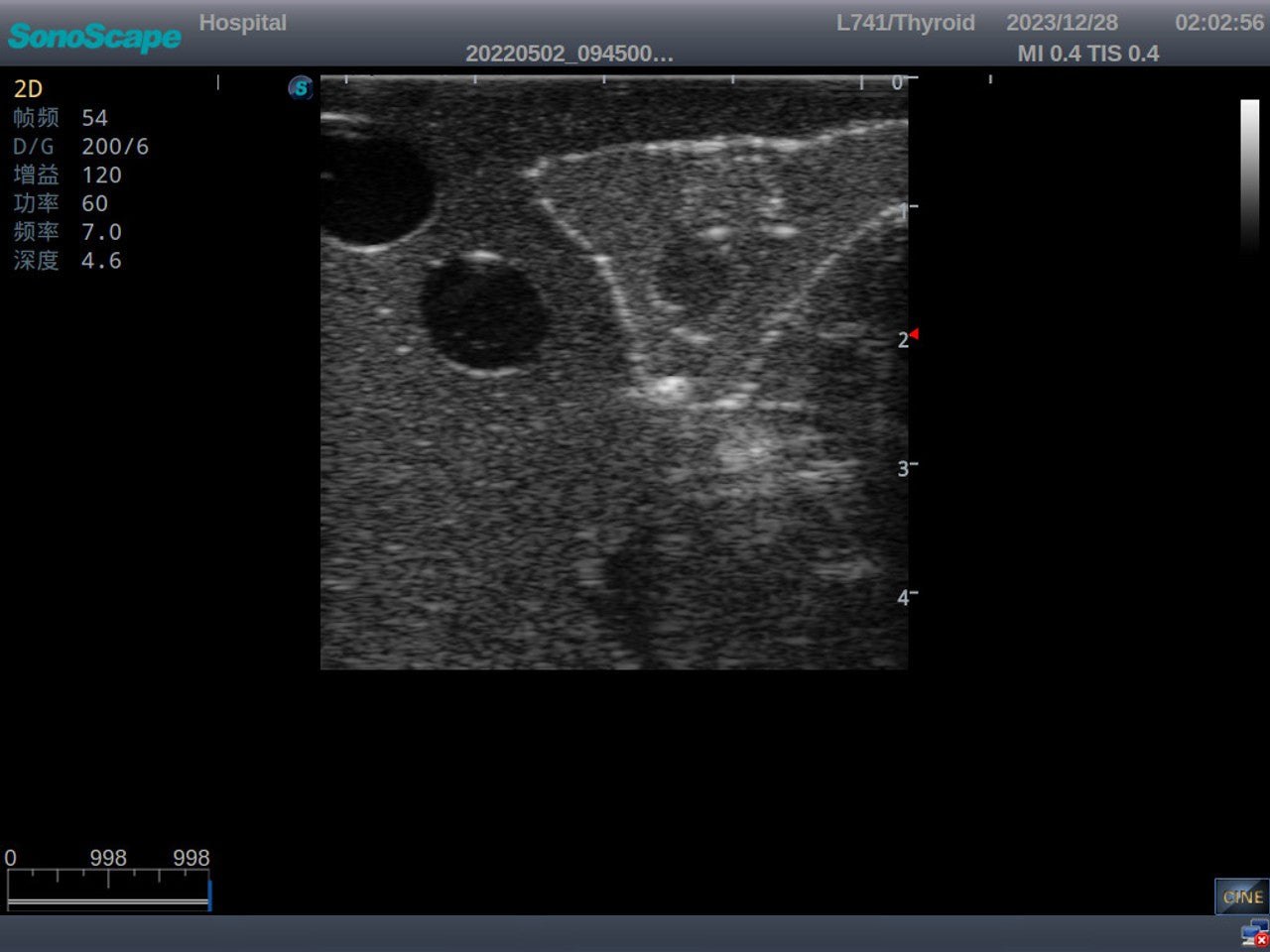 The Anatomy Lab-A-113033 Thyroid Ultrasound Training Model, 1/ea
