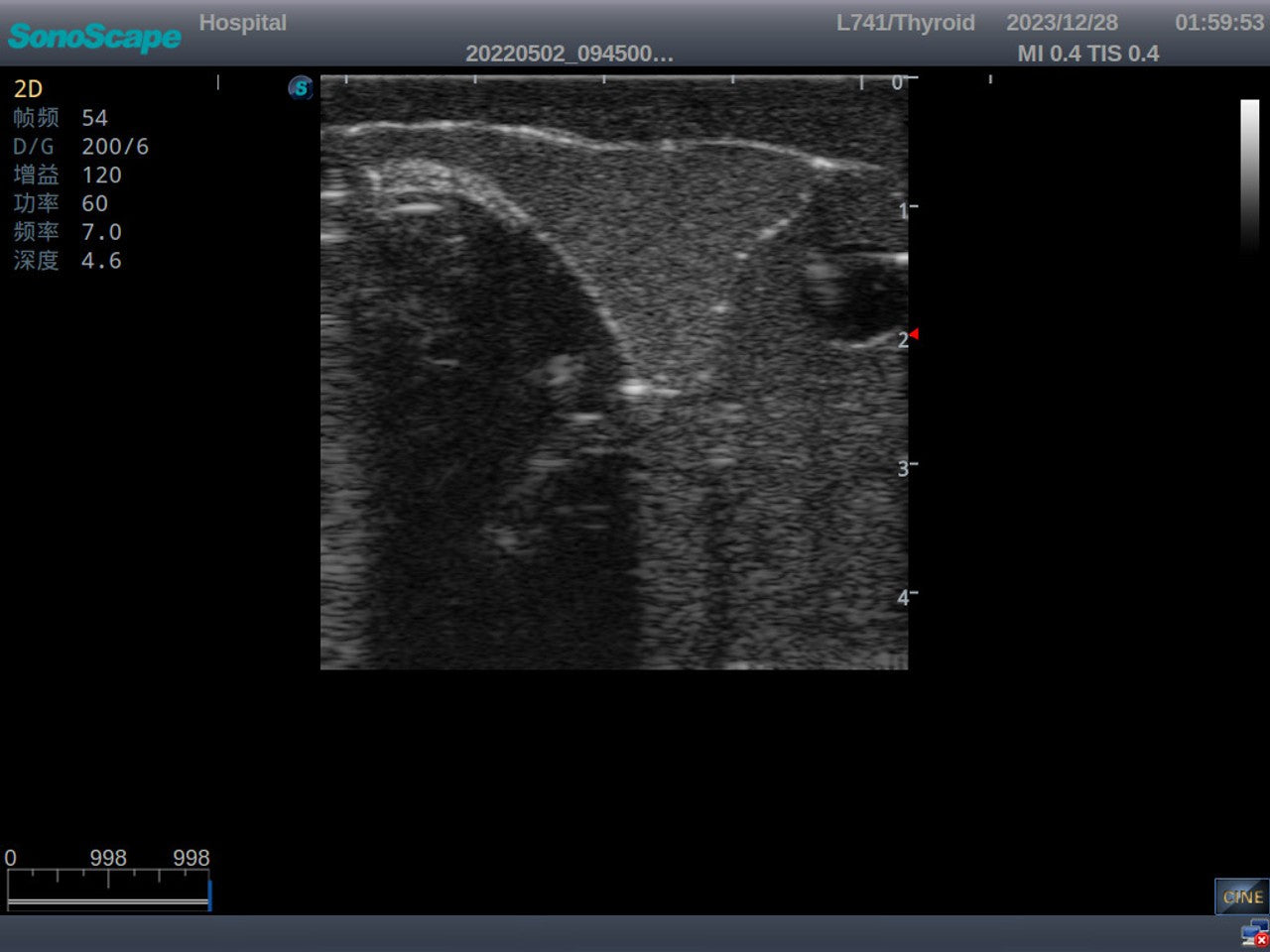 The Anatomy Lab-A-113033 Thyroid Ultrasound Training Model, 1/ea