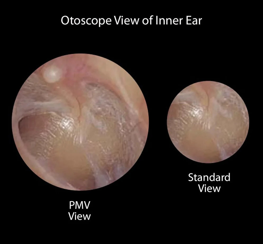 ADC Diagnostix 54802 3.5V Portable PMV Otoscope/Coax Plus Ophthalmoscope Diagnostic Set (1 Each)