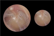 ADC-5681X-36X-Adstation PMV OtoscopeX ThroatX, Spec Disp 1/Ea