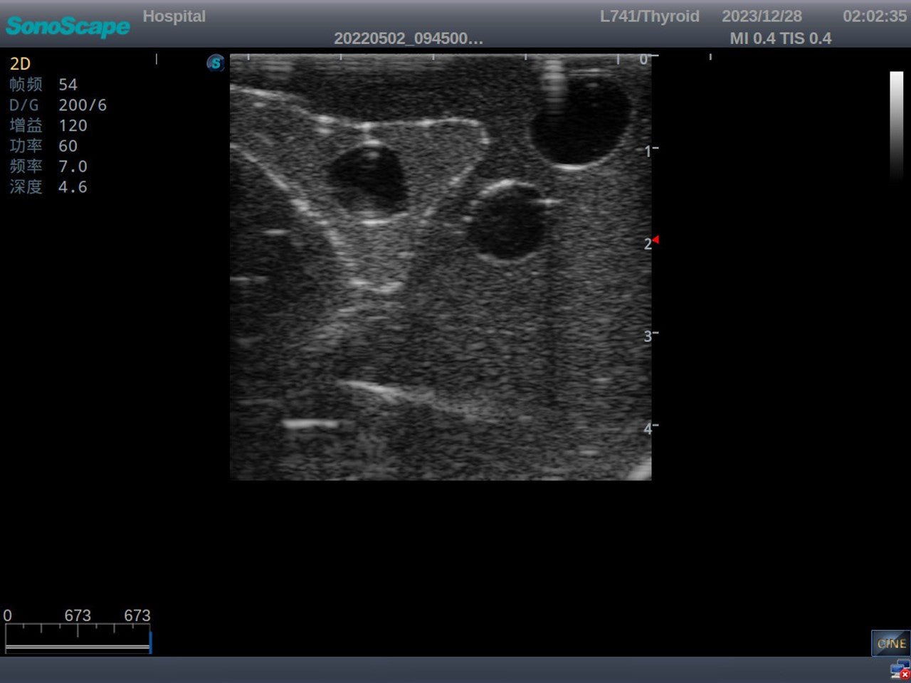 The Anatomy Lab-A-113033 Thyroid Ultrasound Training Model, 1/ea