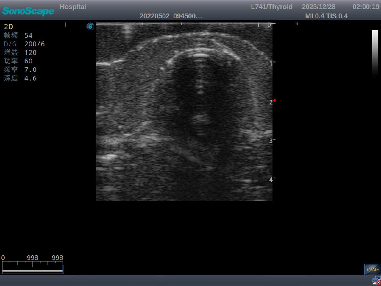 The Anatomy Lab-A-113033 Thyroid Ultrasound Training Model, 1/ea