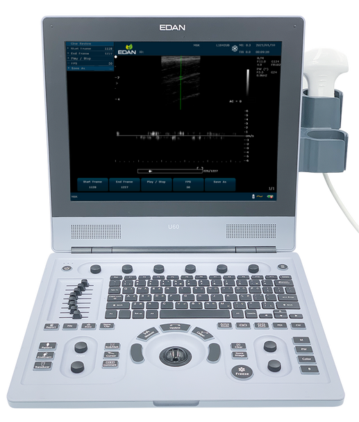 EDAN-U60_Unidad principal de ultrasonido Doppler color (no incluye transductor)