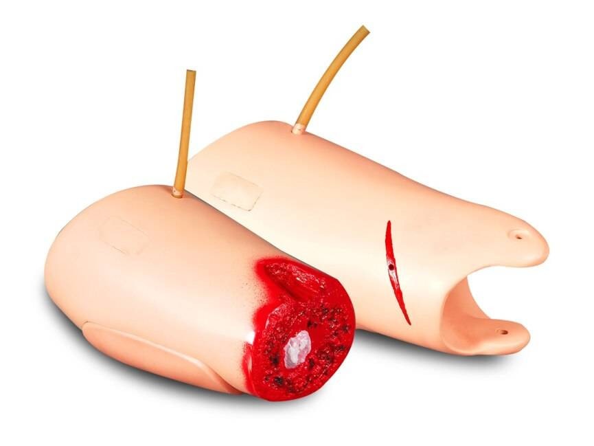 The Anatomy Lab-A-106713 Amputated and Trauma Bleeding Leg