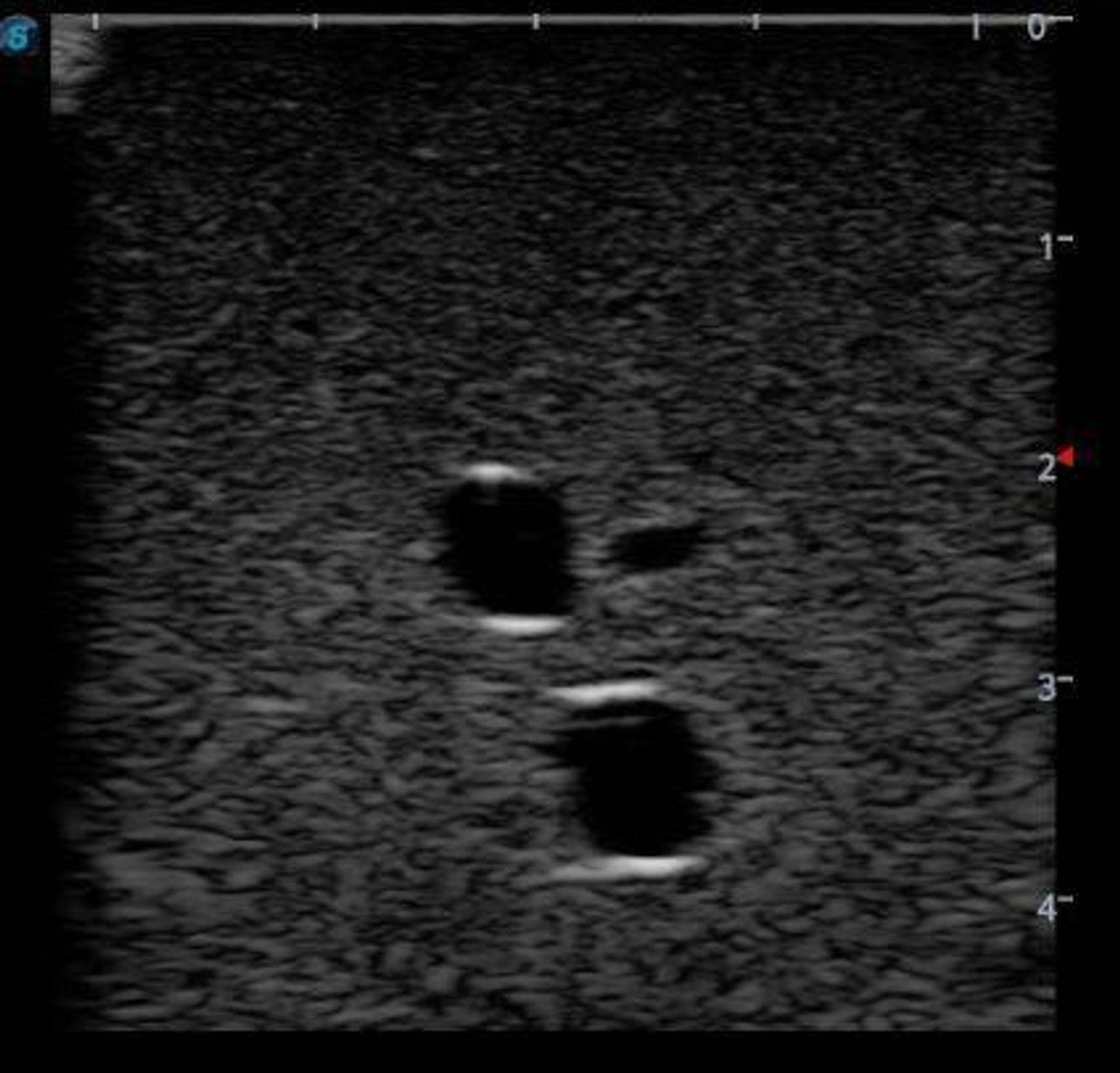The Anatomy Lab-A-108515 Femoral Arteriovenous Puncture and Abdominocentesis Ultrasound Training Model, 1/ea