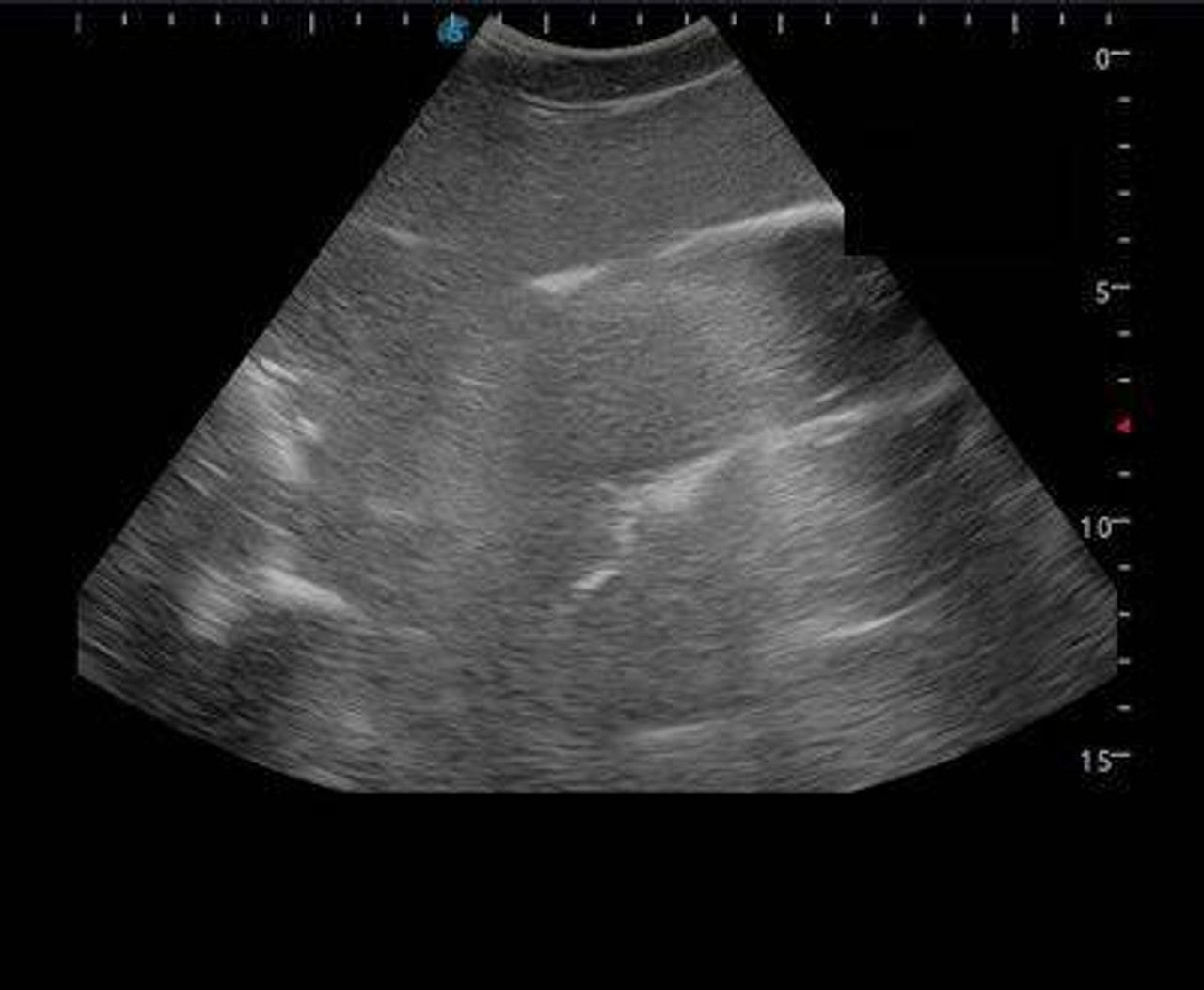 The Anatomy Lab-A-108515 Femoral Arteriovenous Puncture and Abdominocentesis Ultrasound Training Model, 1/ea