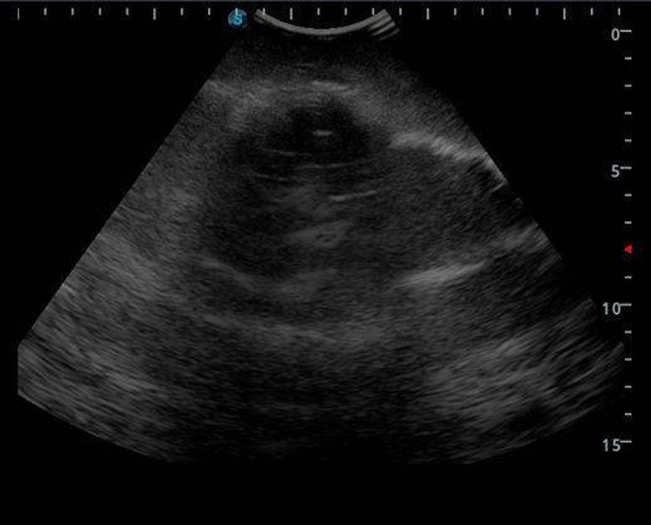 The Anatomy Lab-A-108522 Knee Arthrocentesis Ultrasound Training Model, 1/ea