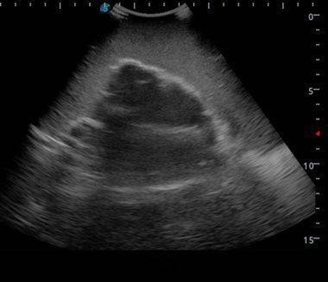 The Anatomy Lab-A-108522 Knee Arthrocentesis Ultrasound Training Model, 1/ea