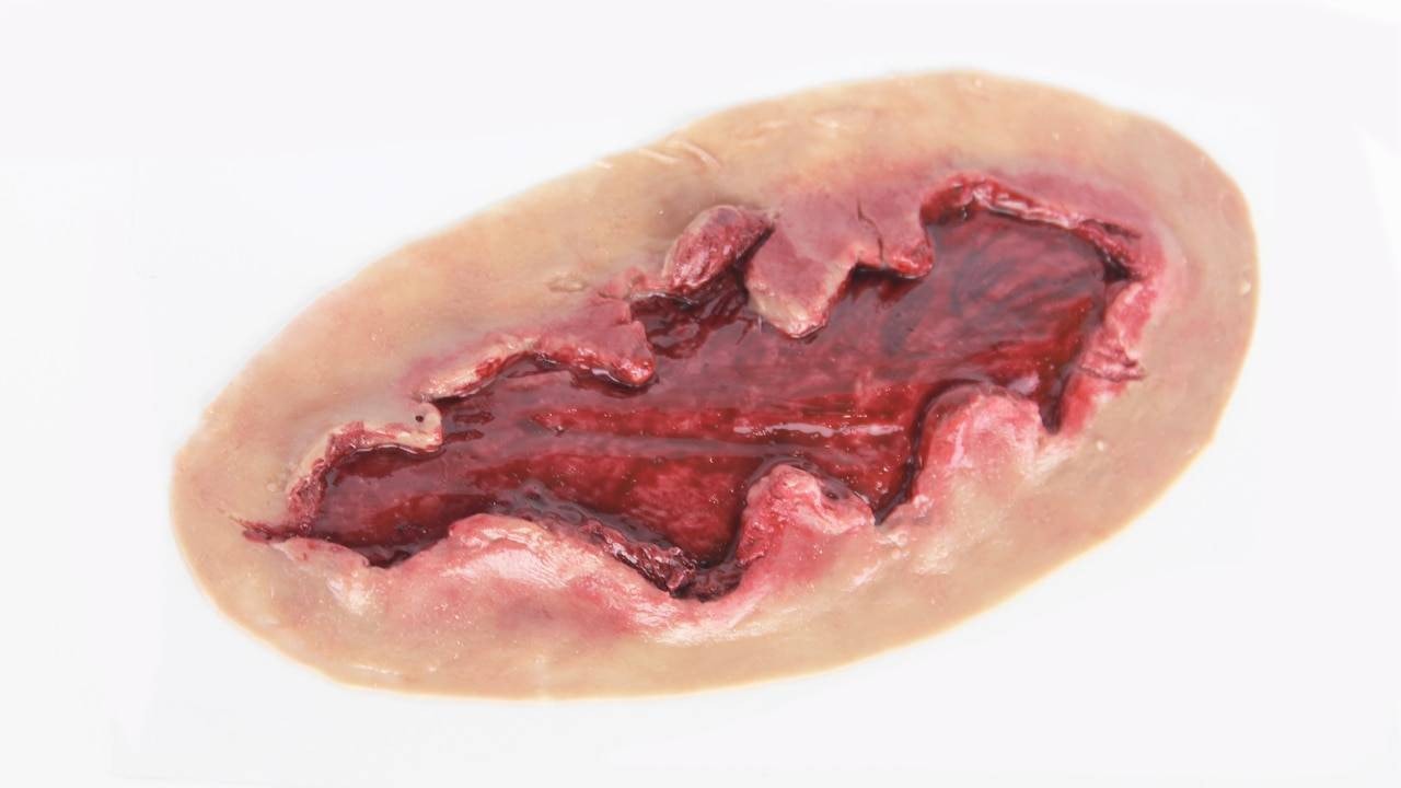 The Anatomy Lab-A-108705 Moulage - Exposed Muscle