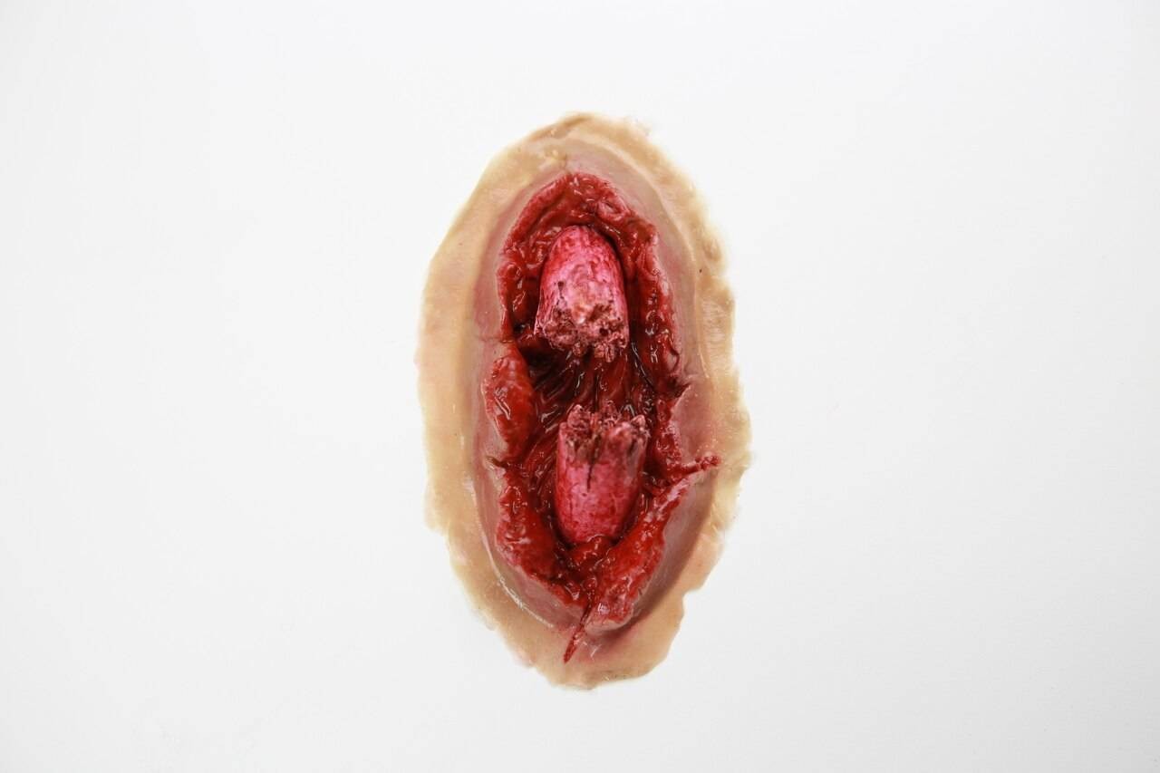 The Anatomy Lab-A-108704 Moulage - Hemorrhaging Compound Fracture