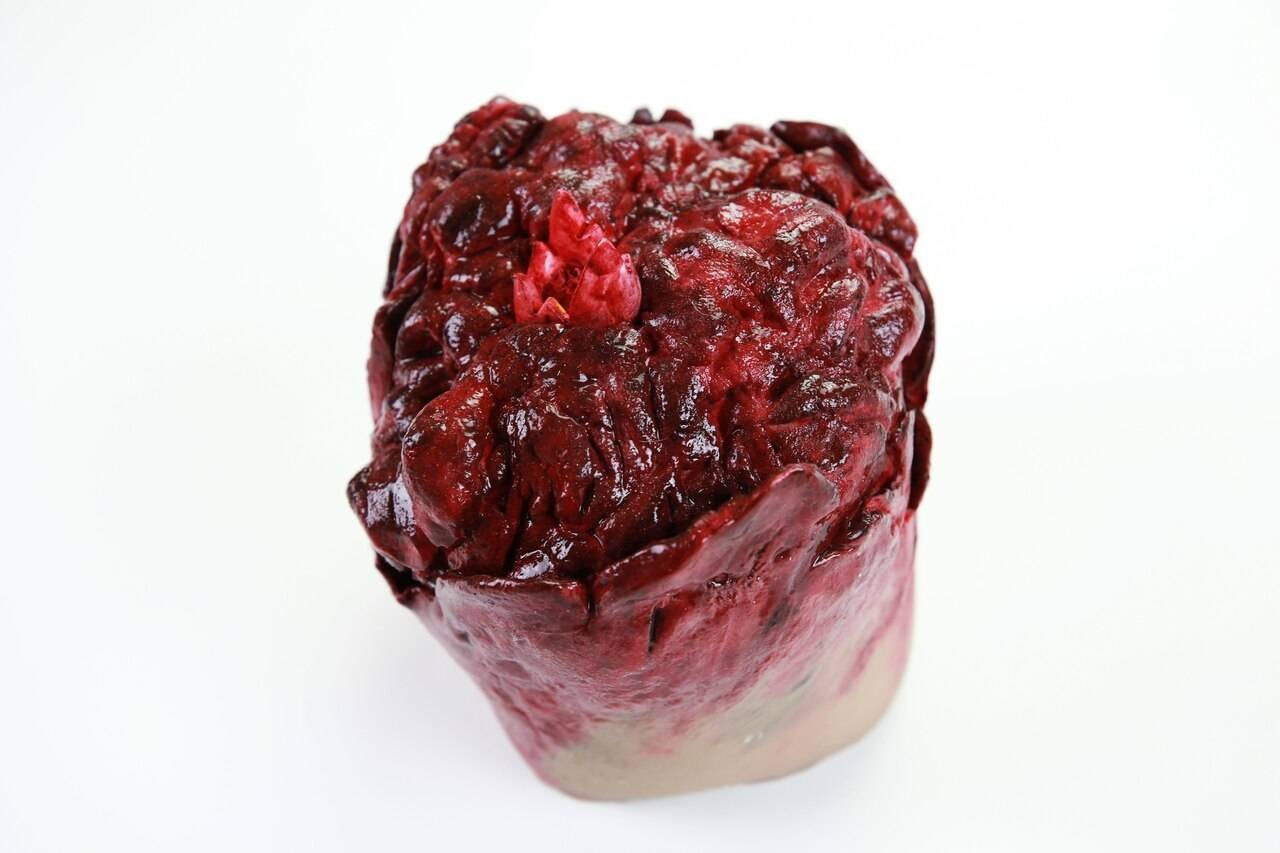 Anatomy Lab Moulage Models