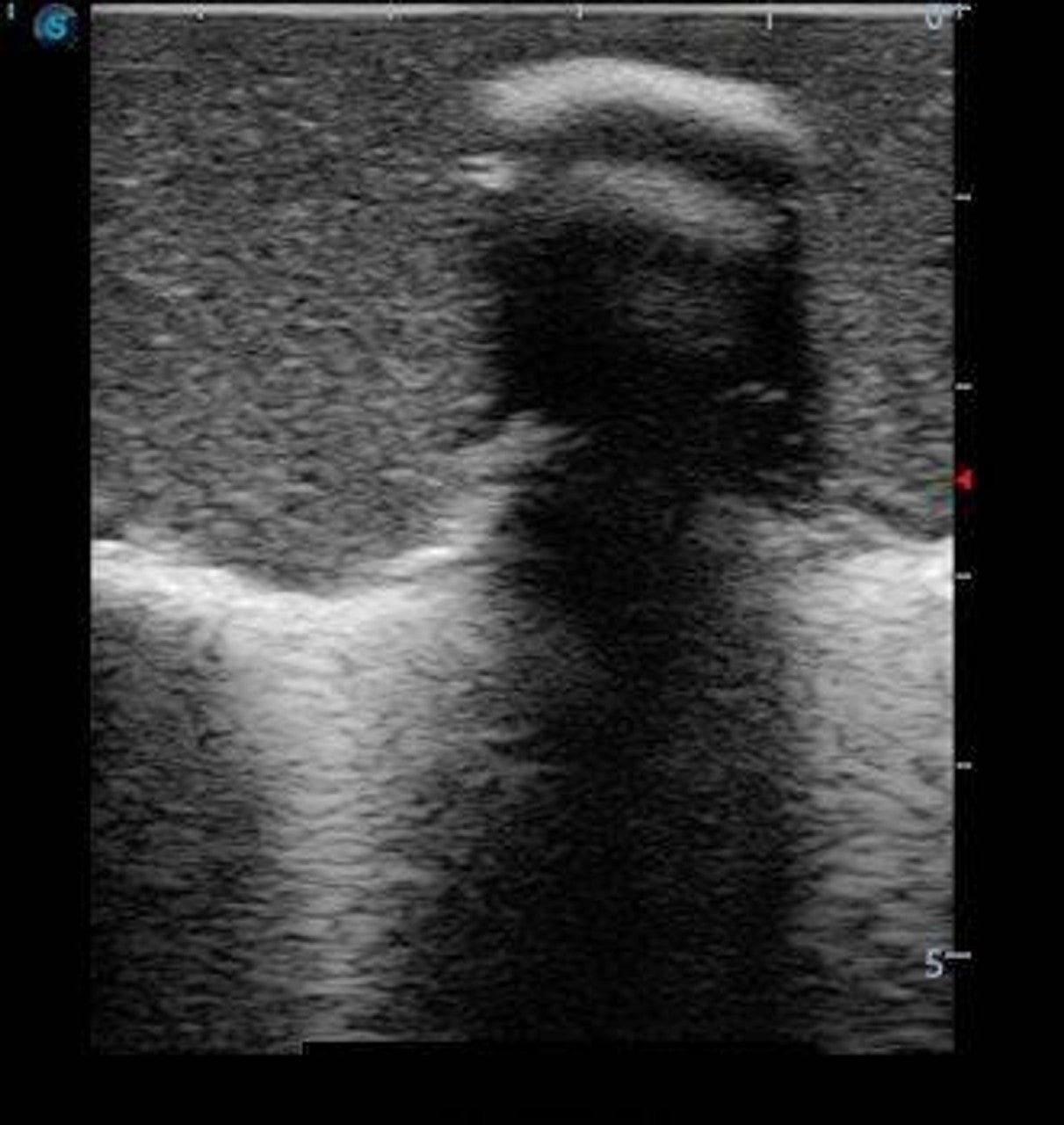 Anatomy Lab Adult & Pediatric Lumbar Puncture Training Model