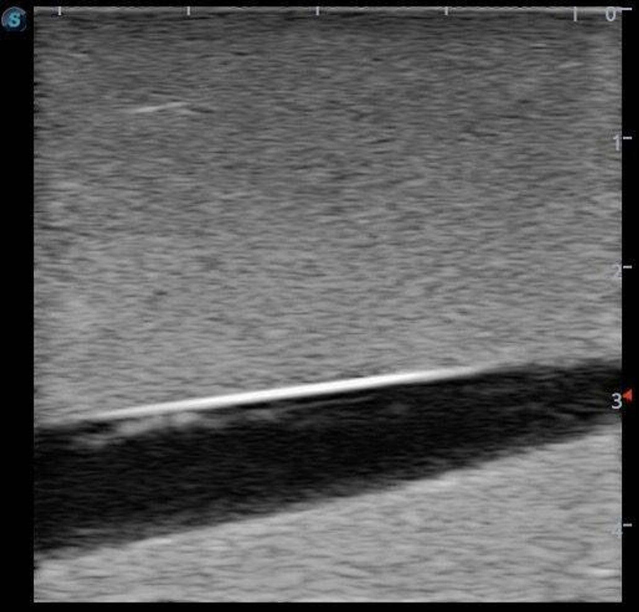 The Anatomy Lab-A-108520 PICC Ultrasound Training Model, 1/ea