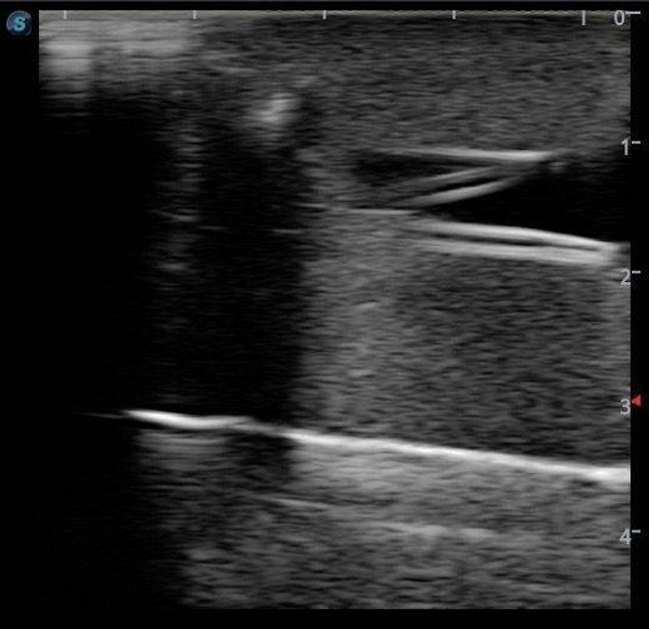 The Anatomy Lab-A-108520 PICC Ultrasound Training Model, 1/ea