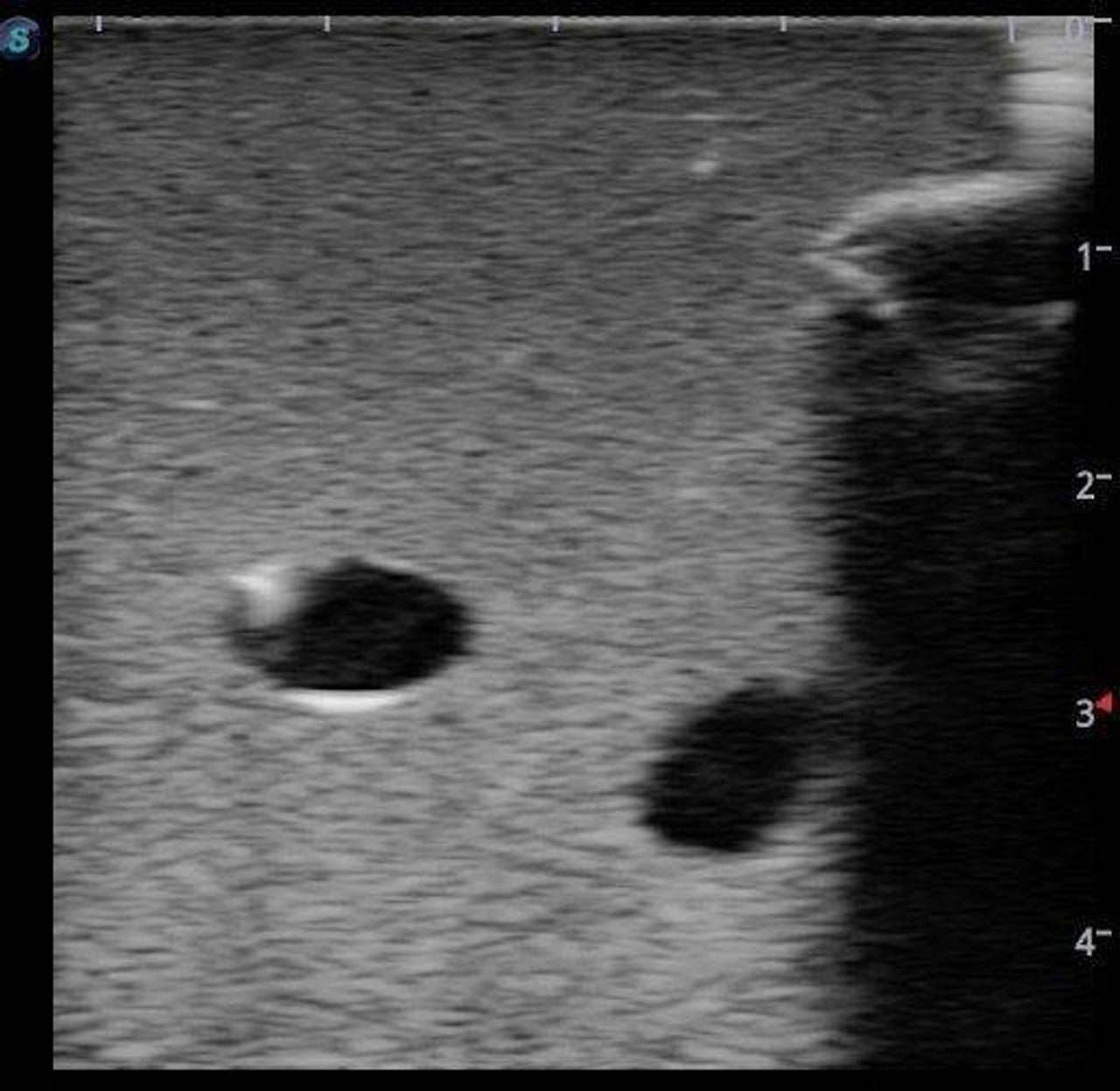 The Anatomy Lab-A-108520 PICC Ultrasound Training Model, 1/ea