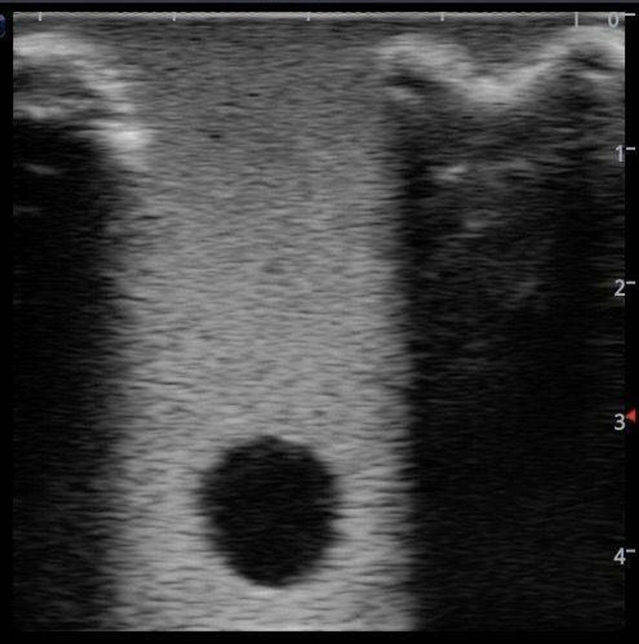 The Anatomy Lab-A-108520 PICC Ultrasound Training Model, 1/ea