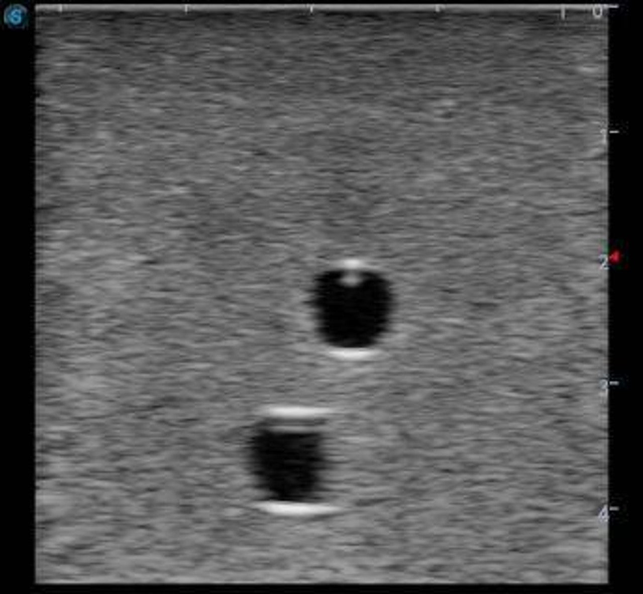 The Anatomy Lab-A-108516 Vascular Access Ultrasound Training Model, 1/ea
