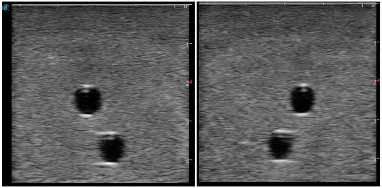 The Anatomy Lab-A-108516 Vascular Access Ultrasound Training Model, 1/ea