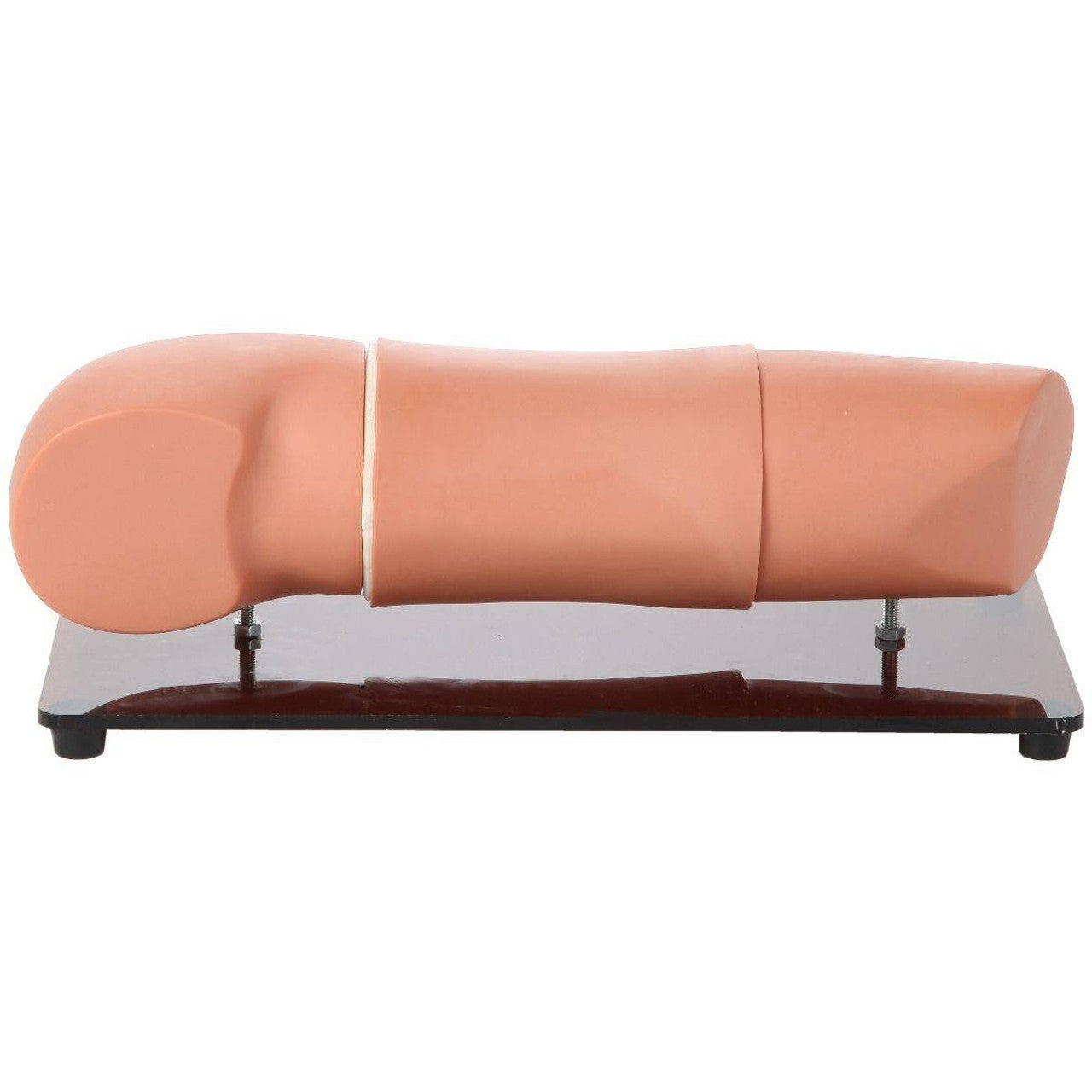 The Anatomy Lab-A-106108 Subcutaneous Embedded Contraception Arm, 1/ea