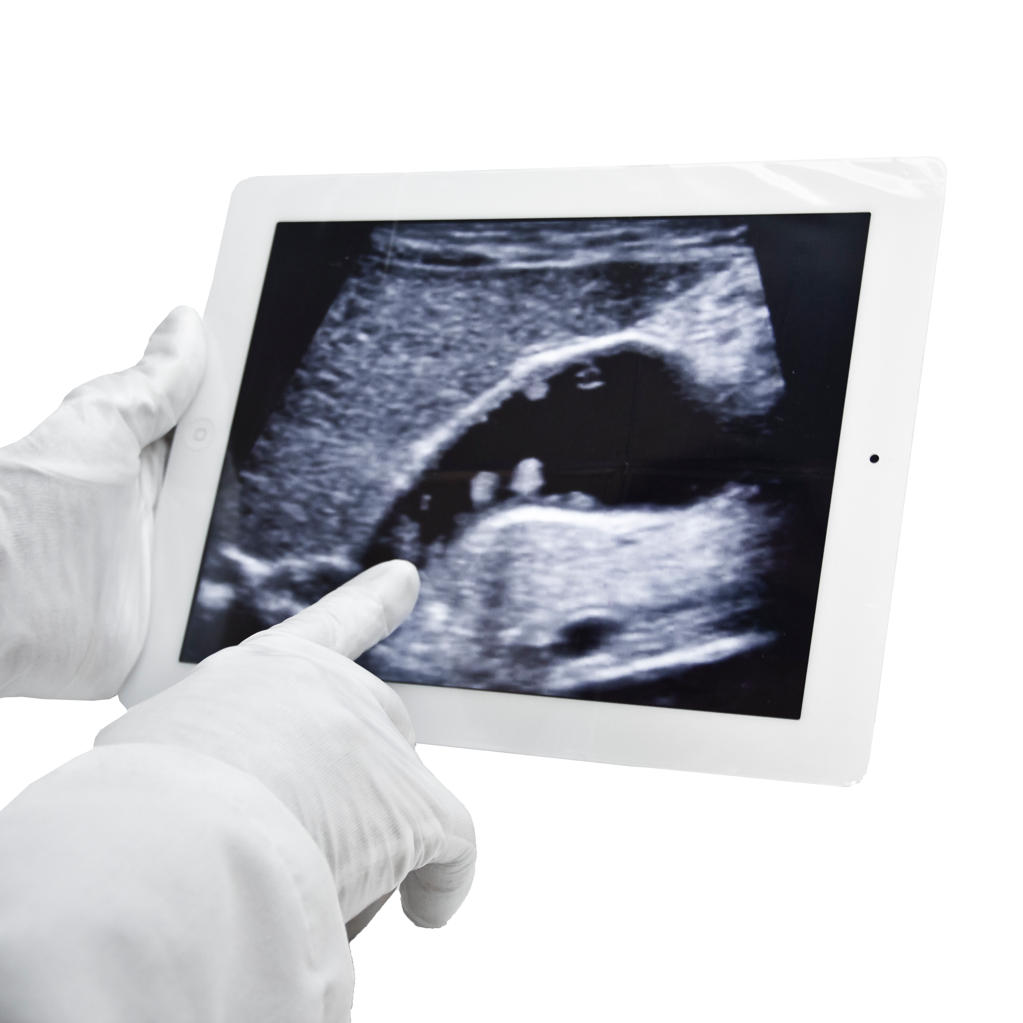 Aspen Surgical Protek Smartphone & Tablet Covers