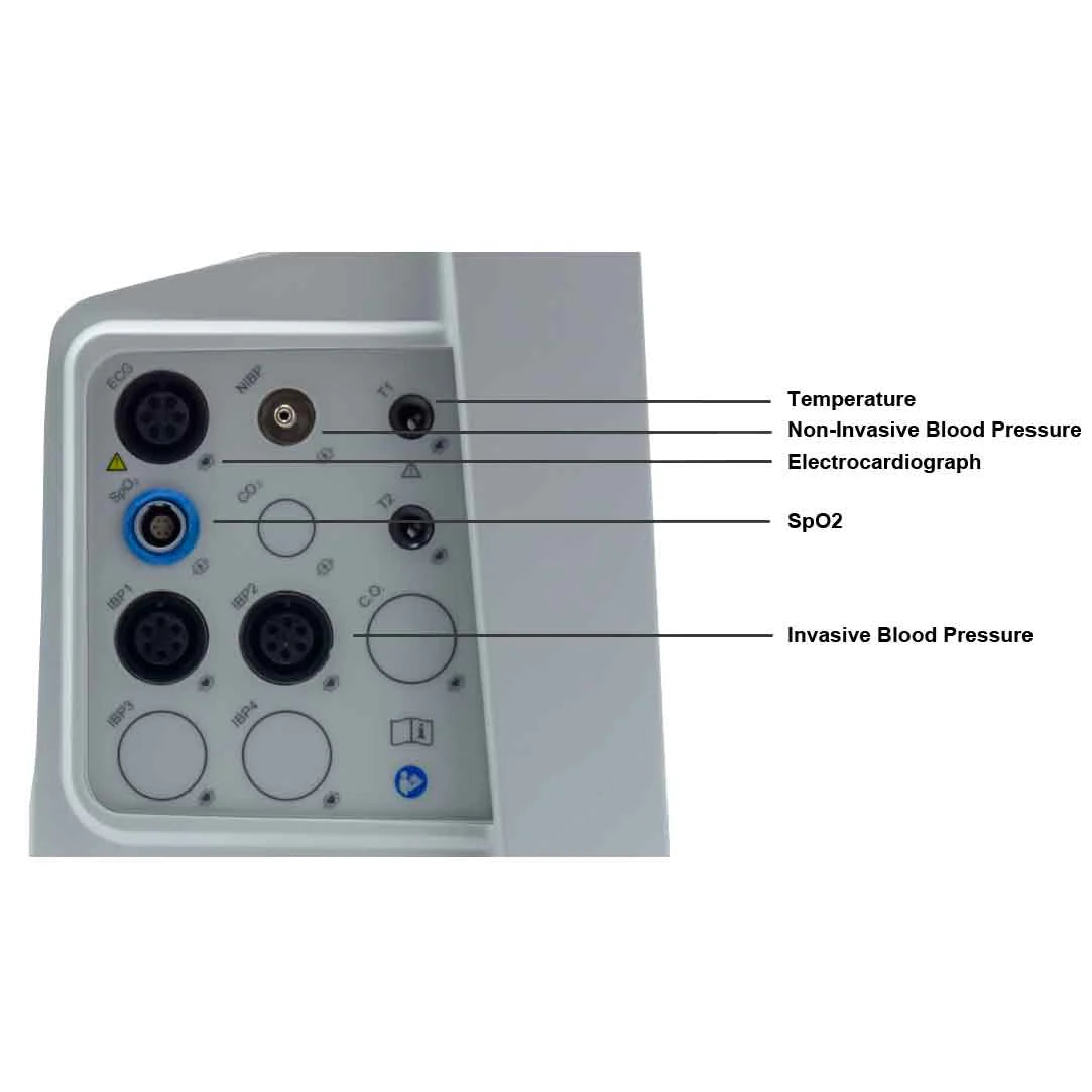 EDAN iM80 Patient monitor with 15'' touch screen. Standard parameters- 3/5-lead ECG, RESP, NIBP, 2-TEMP, PR, HR, EDAN SpO2. Open CO2 and IBP ports. Printer installed.