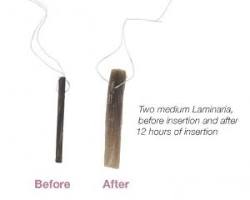 MedGyn Laminaria