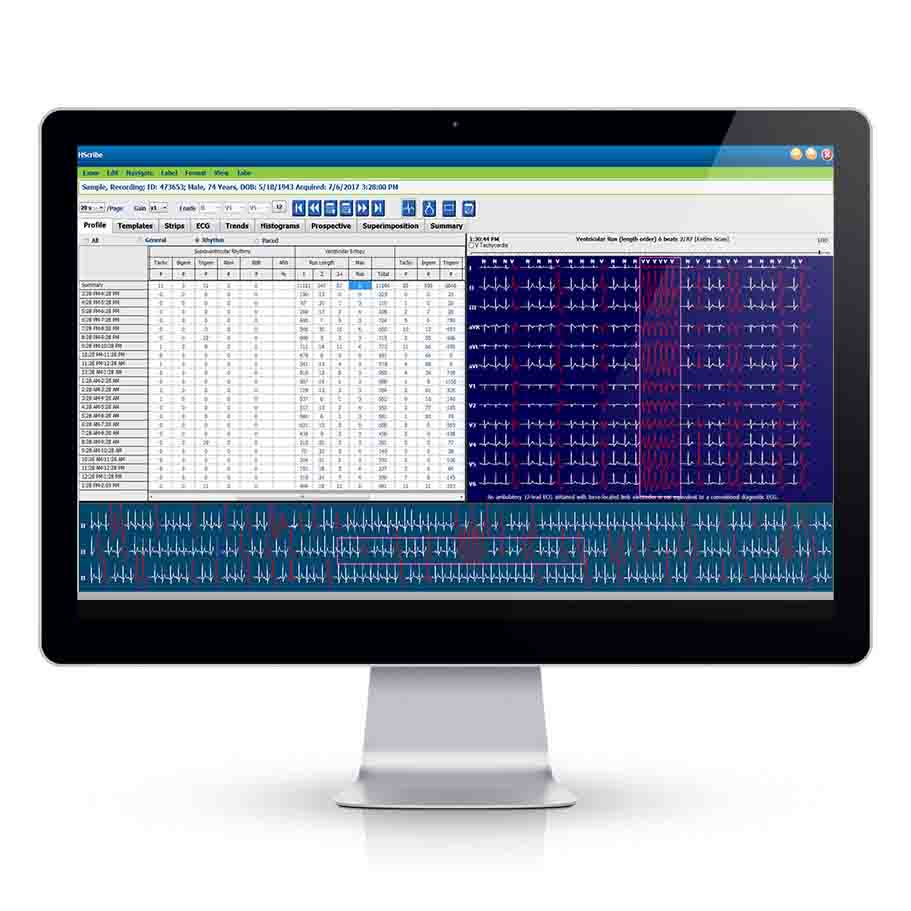 Welch Allyn/Hillrom-HSCRIBE-6AC-YXXXA HScribe Holter Analysis System,Software Package with Report Export and XML Orders(Each)